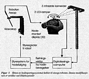 Figur 5    Skisse av hodesporingssystemet koblet til Aesop-roboten. Denne modifikasjonen er utviklet ved Rikshospitalet