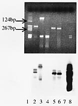 Figur 1    &Oslash;verst) Etidiumbromidfarget gel ved PCR-unders&oslash;kelse for t(14;18). Br&oslash;nn 1 st&oslash;rrelsesmark&oslash;r (ikke DIG-merket);&hellip;