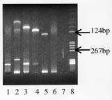 Figur 2    Etidiumbromidfarget gel ved PCR-unders&oslash;kelse av genet for tung immunglobulinkjede (IgH). Br&oslash;nn 1 polyklonal&hellip;