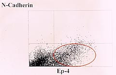 Figur 3  V&aelig;skestr&oslash;mscytometrisk unders&oslash;kelse av ascitesv&aelig;ske med dobbeltfarging for N-cadherin (y-aksen) og Ber-EP4 (EP4, x&hellip;