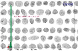 Figur 3    Figuren viser 66 av totalt 364 cellekjerner med tilh&oslash;rende histogram, for en pasient med prostatakreft&hellip;