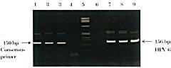 Figur 9    PCR fra pasient 4 for p&aring;visning av humant papilloma-virus (HPV) med konsensusprimere Gp5+/6+ og typespesifikke&hellip;