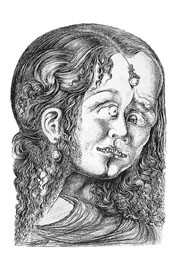  Figur 4    Salvador Dal&icirc;: Macbeth. Dal&icirc; har her grepet til en fremstilling som sees hos enkelte schizofrene, nemlig en&hellip;