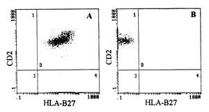  Figur 2    Ved v&aelig;skestr&oslash;mscytometrisk metode p&aring;vises HLA-B27 p&aring;T-lymfocyttenes (CD2) celleoverflate ved hjelp av et&hellip;