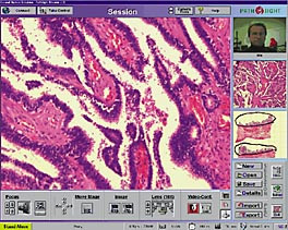 Figur 2    Skjermbilde fra PathSight