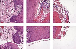 Figur 3    Mosaikken i InterPath
