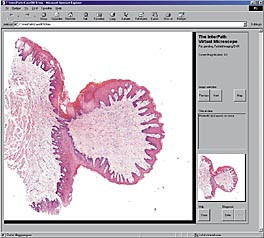 Figur 4    Oversiktsbilde i InterPath