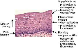  Figur 4    Livssyklusen til humant papillomavirus i flerlaget plateepitel