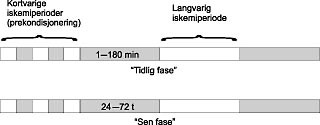  Figur 3    Skjematisk illustrasjon av eksperimentell protokoll for &rdquo;tidlig fase&rdquo; og &rdquo;sen fase&rdquo; av iskemisk&hellip;