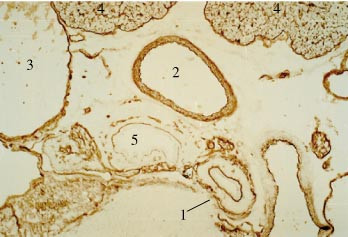  Figur 3    Immunohistokjemisk fremstilling av distribusjonen av endostatin i vev fra museembryo. Snitt med oesophagus &ndash; 1,&hellip;