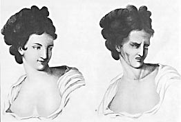 En 23-&aring;rig kvinne &ndash; f&oslash;r og &eacute;n time etter kolerautbruddet (13)