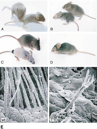  Figur 5    Bildene A-D viser syklisk h&aring;rtap hos trichothiodystrofimusen. Bildene er tatt ved alder 14 dager (A), 19 dager &hellip;