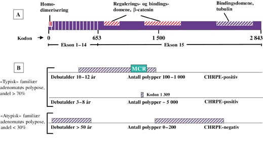  Figur 2    Genotype-fenotype-korrelasjon. Skjematisk fremstilling av APC  [Tom Selection]  -genet og de viktige&hellip;