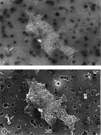 Figur 2  Bilde tatt i et scanningelektronmikroskop av sotpartikler (karbonaggregater) i en svevest&oslash;vspr&oslash;ve fra et hjem med&hellip;
