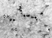 Figur 2   V&auml;vnadssnitt genom ryggm&auml;rgens bakhorn som visar att &ouml;strogenreceptorer &auml;r lokaliserade till opiatproducerande&hellip;