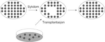 Figur 2   Figuren indikerer vevsskade som oppst&aring;r ved sykdom som f.eks. hjerteinfarkt eller hjerneslag. Stamceller, eller&hellip;