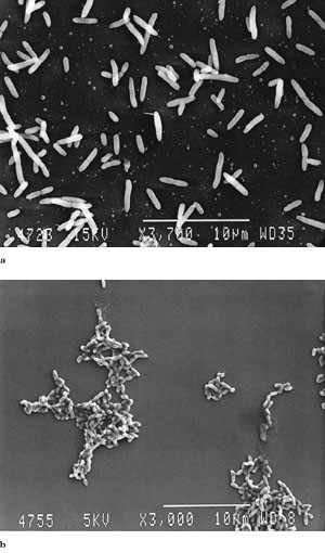 Figur 3   Elektronmikroskopibilde av Pseudomonas fluorescens dyrket a) uten tilstedev&aelig;relse av desinfeksjonsmiddel (3 700 &sdot;&hellip;