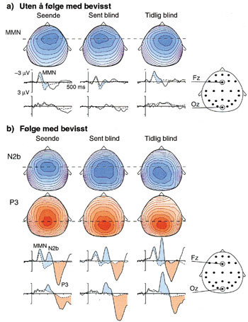 Figur 6   Aktivering av synsbarken under den samme auditive oppgaven hos personer blinde fra en tidlig alder versus blinde&hellip;