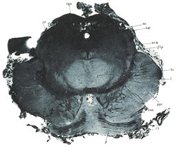 Figur 10   Fotogravyr av snitt fra sentralnervesystemet 1892 (13). Foto Universitetsbiblioteket, Oslo