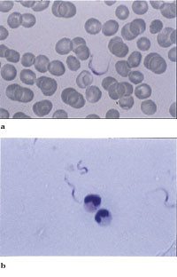 Figur 3   a) En trypanosom mellom erytrocytter i tynn dr&aring;pe (blodutstryk). b) Tre trypanosomer (og to granulocytter) i tykk&hellip;