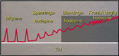 Figur&thinsp;&thinsp;1 Utvikling av kronisk daglig hodepine, som nesten alltid er assosiert med overforbruk av symptomdempende&hellip;