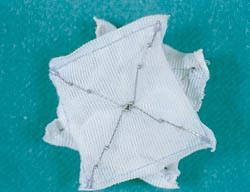 Figur 3 CardioSEAL 23 mm