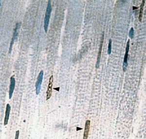 Figur 3 Apoptose av hjertemuskelceller fra en rotte med hjerteinfarkt. Cellekjernene til apoptotiske celler er farget brune &hellip;