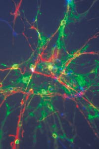 Stamceller i menneskehjernen: nerveceller fremst&aring;r som r&oslash;de, astrocytter som bl&aring; og oligodendrocytter som gr&oslash;nne. Foto Neuro&hellip;