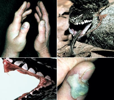 Hoggormens hoggtann er godt synlig n&aring;r den er klar til bruk, underkjeven er sv&aelig;rt b&oslash;yelig og kan hengsles av i kjeveleddet&hellip;