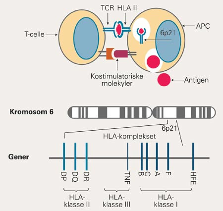 Den sykdomsassosierte haplotypen HLA-DR2, DQ6 koder for HLA-klasse II-molekyler, som er sentrale i immunreaksjonen. HLA&hellip;