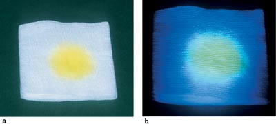 Figur 4  Fortynnet natriumfluorescein i a) daglys og b) under bl&aring;lys