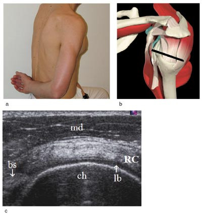 Figur 4  Lateral-transversal projeksjon: a) Armens posisjon for fremstilling av rotatorcuffen b) Anatomi med plassering av&hellip;