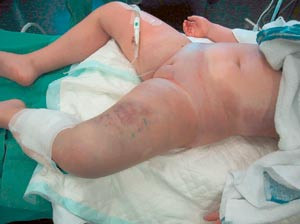 Figur 3  L&aring;r bitt av hoggorm. Foto Sverre Refstad