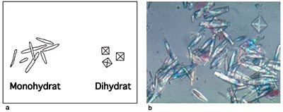 Figur 7  Krystalluri ved etylenglykolforgiftning. a) Strektegningen viser de to hovedtypene av kalsiumoksalatkrystaller:&hellip;
