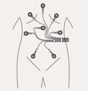 Figur 2  Signalene fra kapselen registreres via sensorer som festes p&aring; huden i et bestemt m&oslash;nster. Dette gj&oslash;r det mulig &aring;&hellip;