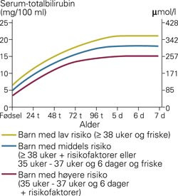 Nye amerikanske retningslinjer for lysbehandling av nyf&oslash;dte med gulsott (15, gjengitt med tillatelse)
