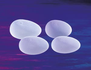 Figur 1  Anatomiske silikonbrystimplantater. Bemerk dr&aring;peformen og den rue overflaten p&aring; implantatene. Bilde utl&aring;nt av&hellip;