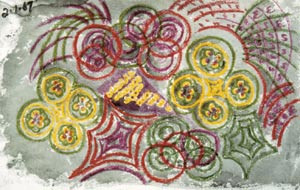 Figur 2  Visuell aura (ca. 1967). Miss J.R.B.