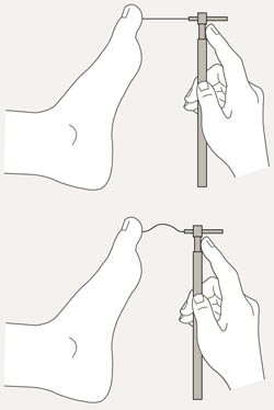 10-g Semmes-Weinstein-monofilament. Pasienten skal ikke se p&aring; f&oslash;ttene n&aring;r disse unders&oslash;kes. Man tester tre steder i planta&hellip;