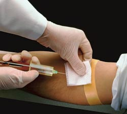 Hormonet NT-proBNP er prognostisk viktig ved kronisk hjertesykdom. Foto Lester Lefkowitz/Corbis/SCANPIX