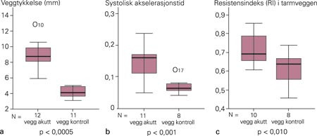 Veggtykkelse (a), systolisk akselerasjonstid (b) og resistensindeks (c) i colon ved akutt iskemisk kolitt. Diagrammene viser&hellip;