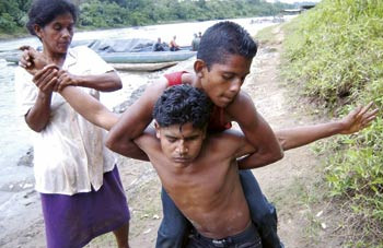 Gutten er angrepet av grisi siknis og f&aring;r hjelp av familien. Foto La Prensa