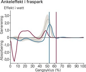 Pasient 2. Kinetiske ankelkurver av venstre fot i sagittalplan. Horisontal r&oslash;d kurve er preoperativt, bl&aring; kurve er&hellip;