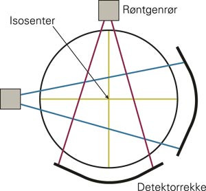 Figuren viser r&oslash;ntgenr&oslash;rets og detektors plassering ved frontscout (r&oslash;d markering) og sidescout (bl&aring; markering). Isosenter&hellip;