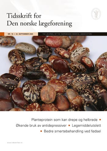 Kastorb&oslash;nner. Foto Marianne Loraas