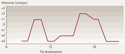 Eksempel p&aring; p&aring;-av-registrering av peroralt behandlet pasient. Pasientens funksjon blir vurdert p&aring; en VAS-skala, der motorisk&hellip;