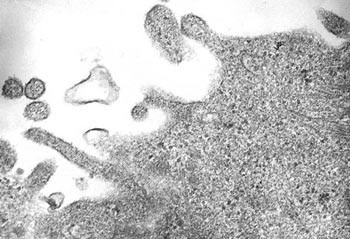 Figur 3  Elektronmikroskopisk bilde av hMPV-partikler i celledyrking (52 800 x forst&oslash;rret, Are B. Dalen, 2003)