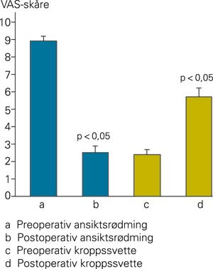 Effekten av torakoskopisk sympatektomi p&aring; ansiktsr&oslash;dming. Endring i plager p&aring; en visuell analog skala etter gjennomsnittlig&hellip;