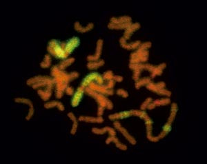 Figur 2 Metafasekromosomer fra et veldifferensiert liposarkom, merket med en fluorescerende probe for sekvenser fra kromosom&hellip;