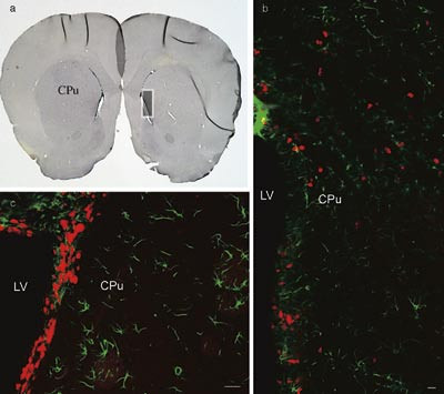 Figur 2  Snitt gjennom basalgangliene etter injeksjon med 6-OHDA og behandling. a) Rektangelet viser hvor utsnittene b og c&hellip;